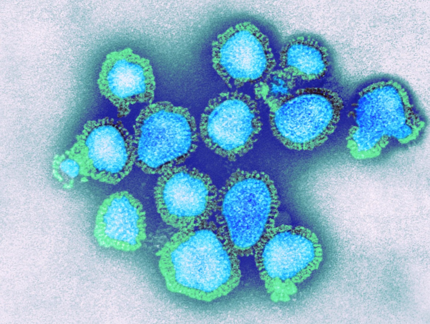 Hindistan'da H3N2 virüsü: İlk ölümler kaydedildi