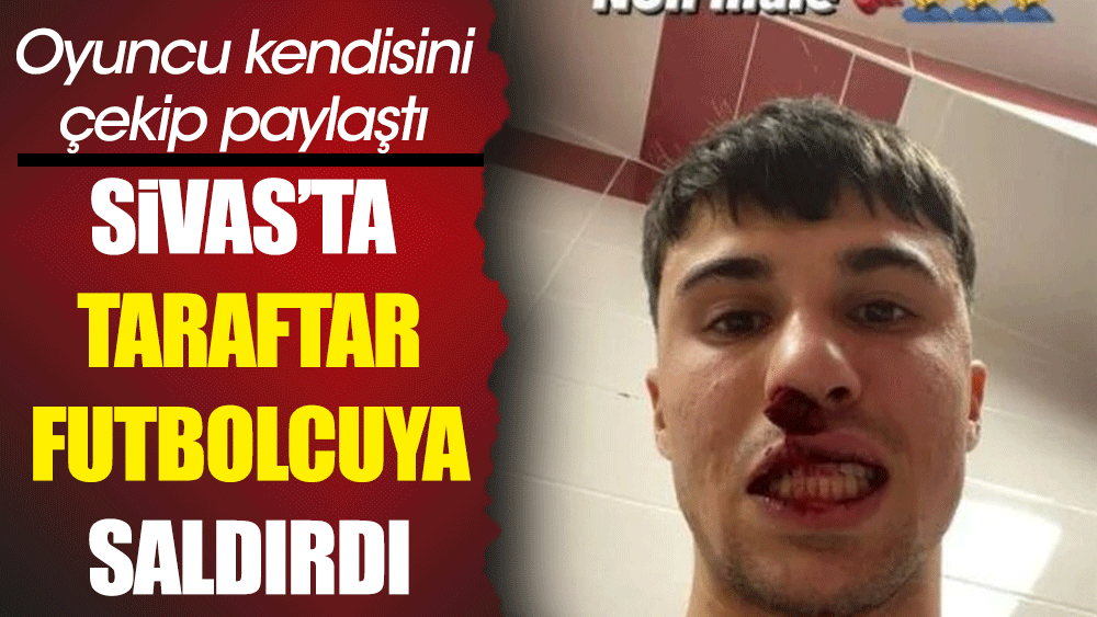 Sivas'ta İtalyan futbolcuya skandal saldırı. Fiorentina teknik direktörü isyan etti