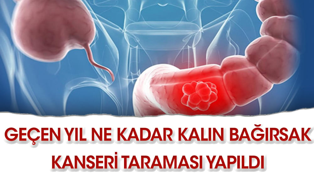 Geçen yıl ne kadar kalın bağırsak kanseri taraması yapıldı