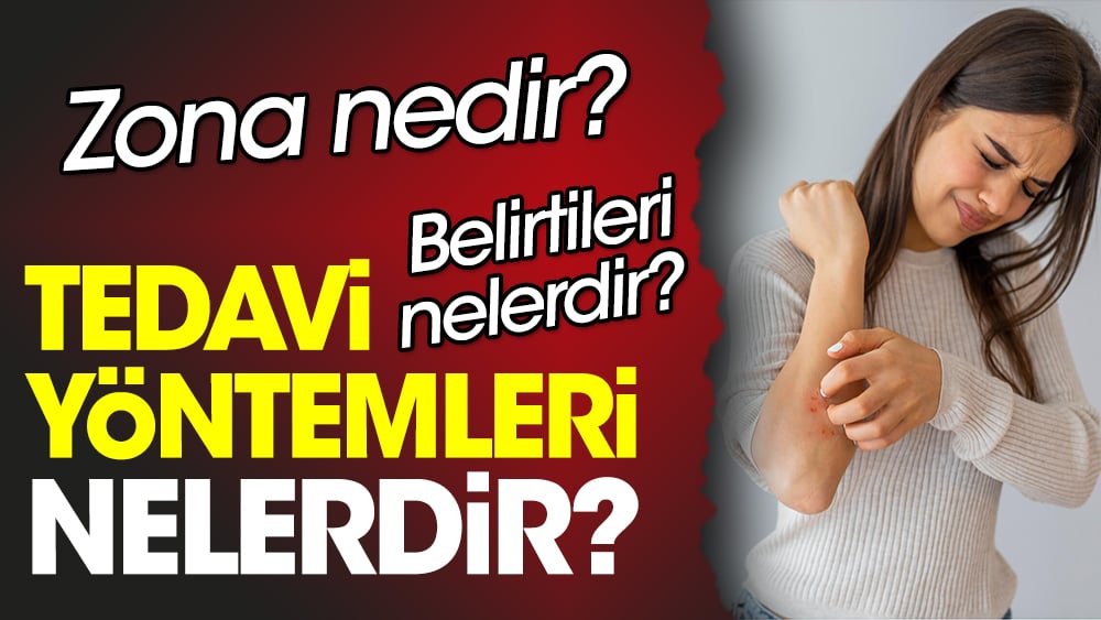 Zona nedir? Zona belirtileri nelerdir? Zona tedavi yöntemleri nelerdir?