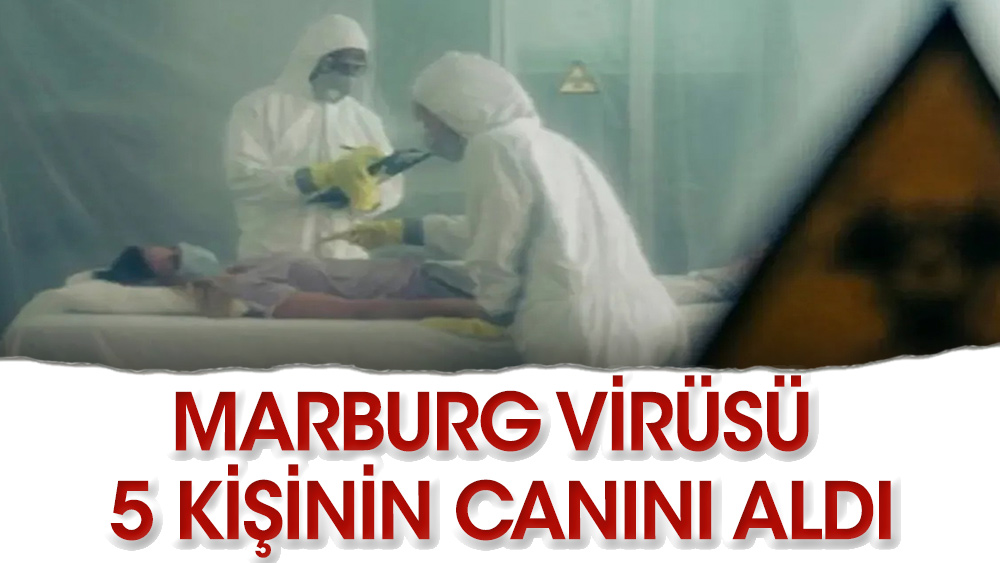 Bu da yeni bela: Marburg virüsü 5 kişinin canını aldı