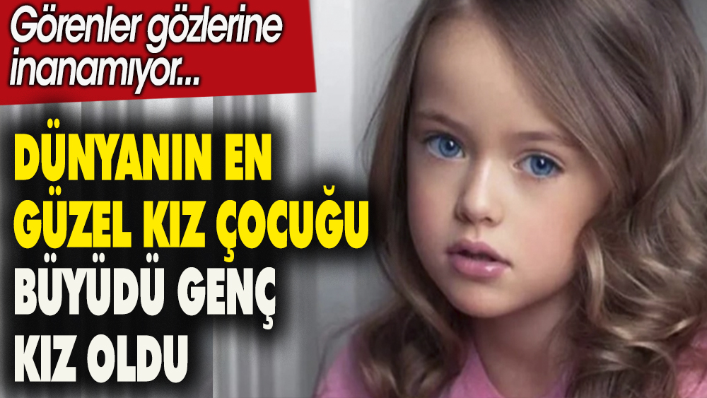 Dünyanın en güzel kız çocuğu büyüdü genç kız oldu. Görenler gözlerine inanamadı