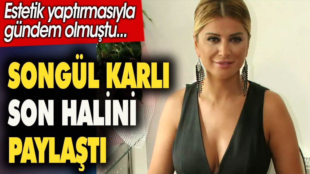 Songül Karlı son halini paylaştı .Estetik yaptırmasıyla gündem olmuştu