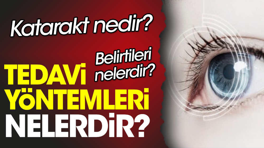 Katarakt nedir? Katarakt belirtileri nelerdir? Katarakt tedavi yöntemleri nelerdir?