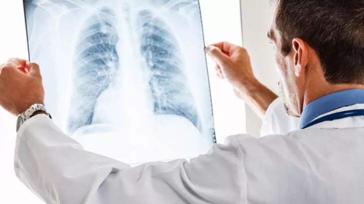 Akciğer enfeksiyonu nedir?