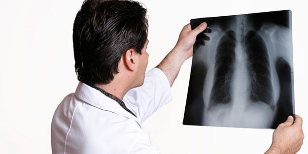 Akciğer enfeksiyonu belirtileri nelerdir?