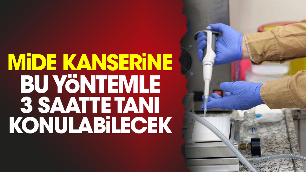 Mide kanserine bu yöntemle 3 saatte tanı konulabilecek