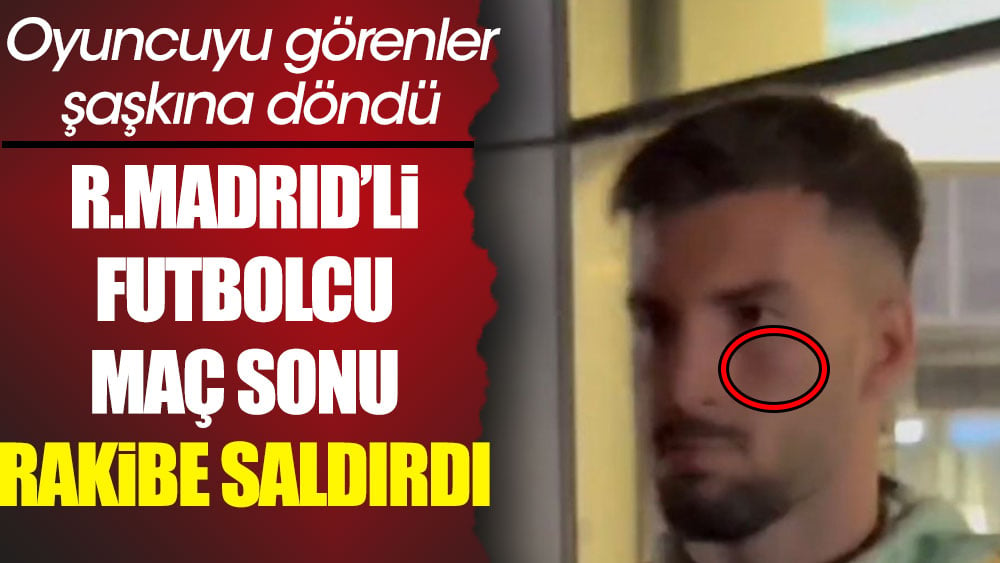 Real Madrid'li oyuncu Villareal'li oyuncuya saldırdı. Oyuncunun son halini görenler şaşkına döndü