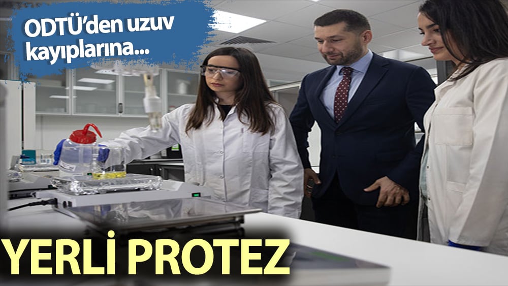 ODTÜ'den uzuv kayıplarına yerli protez