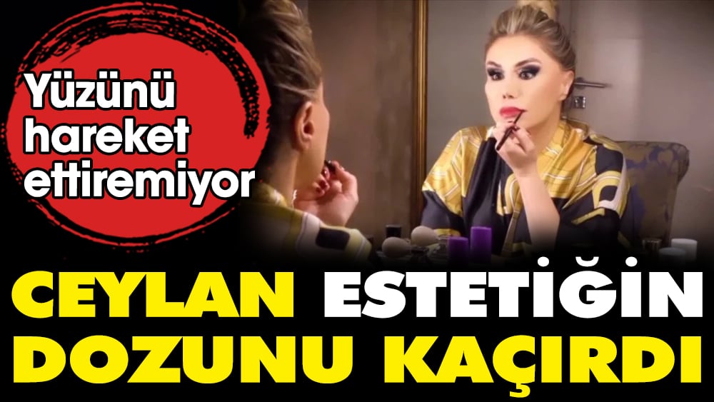 Şarkıcı Ceylan estetiğin dozunu kaçırdı. Yüzünü hareket ettiremiyor