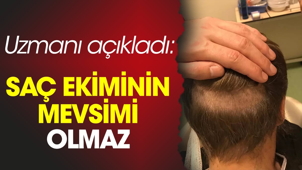 Uzmanı açıkladı: Saç ekiminin mevsimi olmaz