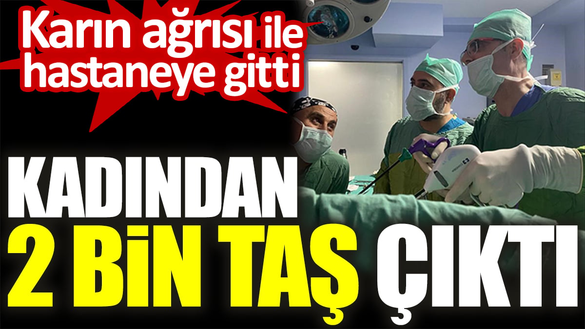 Karın ağrısı ile hastaneye gitti. Kadından 2 bin taş çıktı