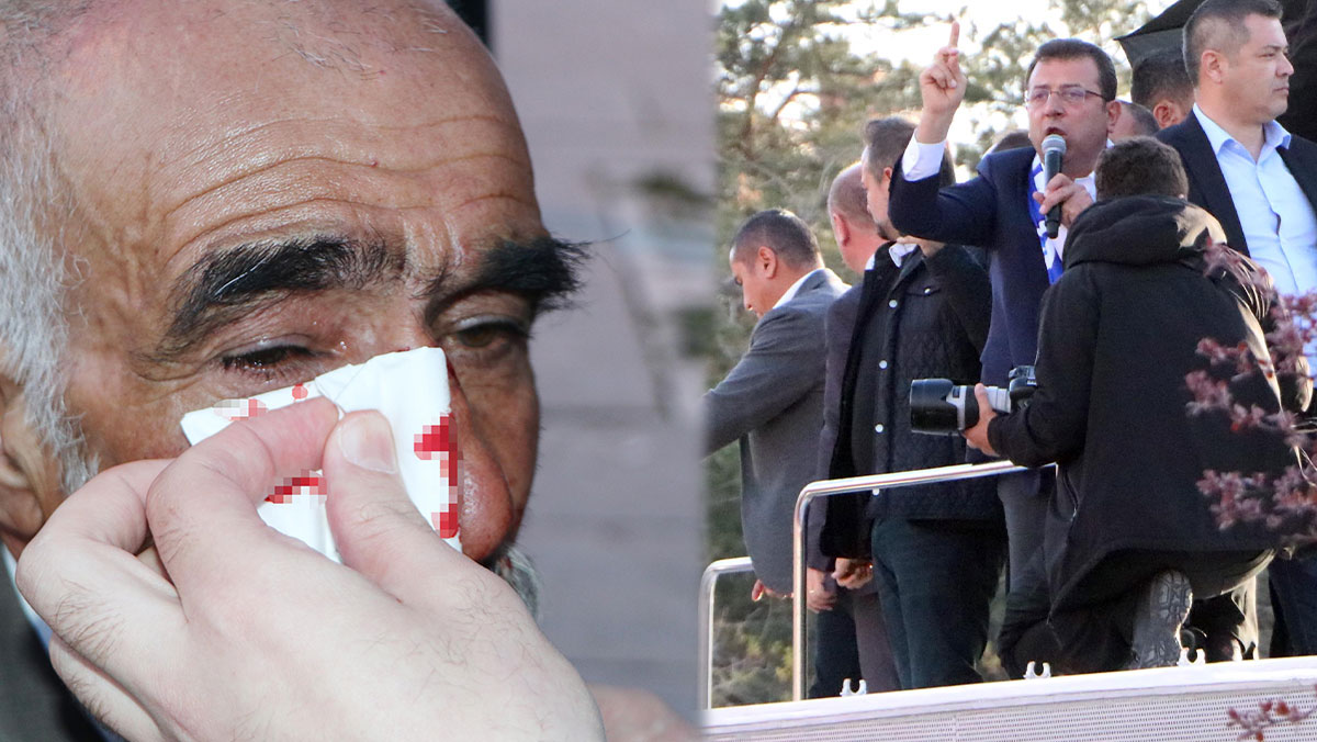 İmamoğlu'nun mitinginde taşlı saldırıda yaralanan 17 kişi taburcu edildi