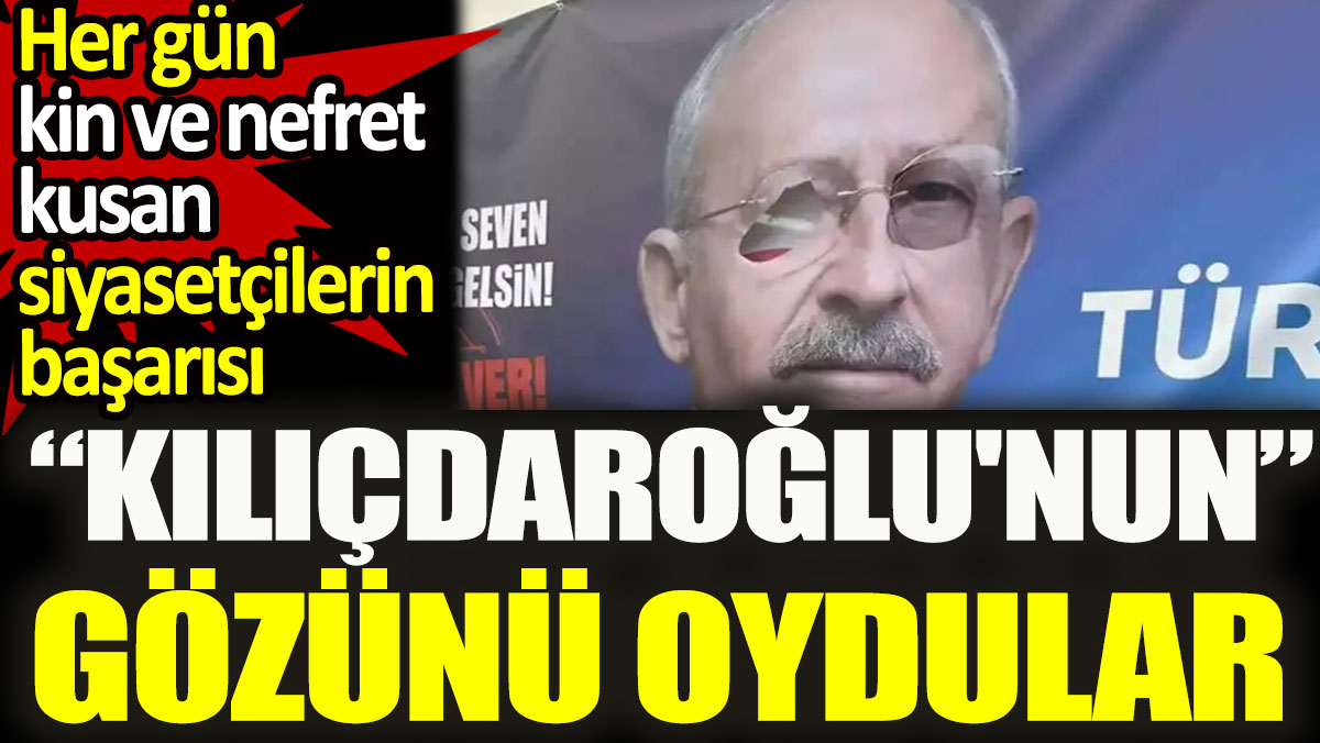Kılıçdaroğlu'nun gözünü oydular