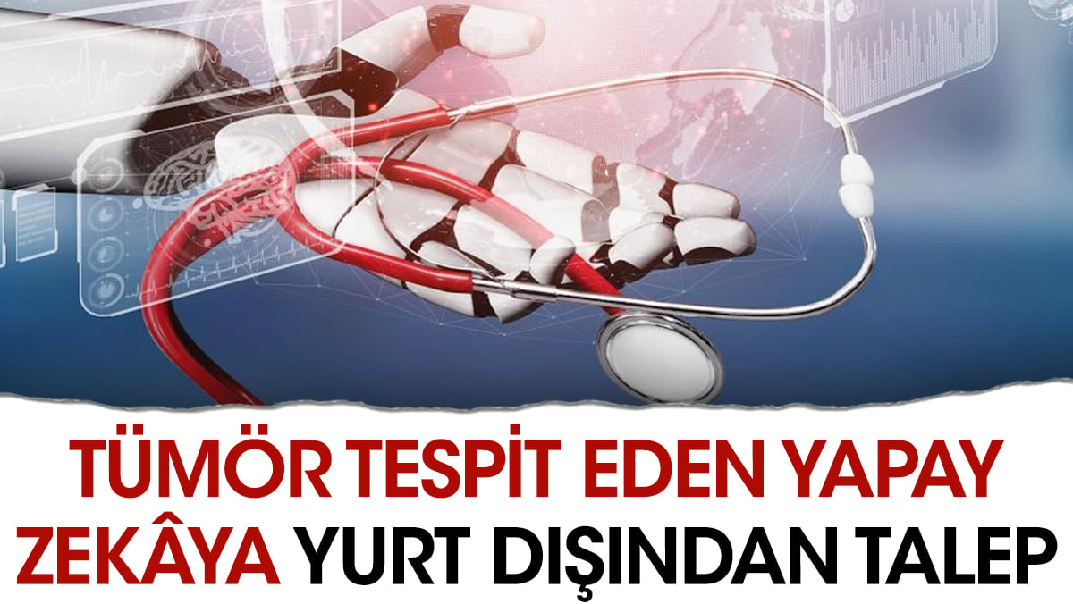 Tümör tespit eden yapay zekâya yurt dışından talep