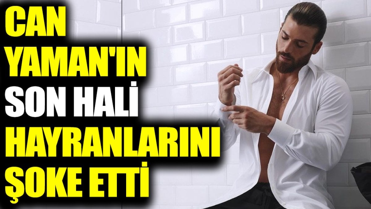 Can Yaman'ın son hali hayranlarını şoke etti