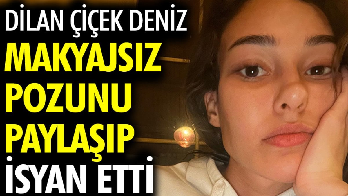 Dilan Çiçek Deniz makyajsız pozunu paylaşıp isyan etti