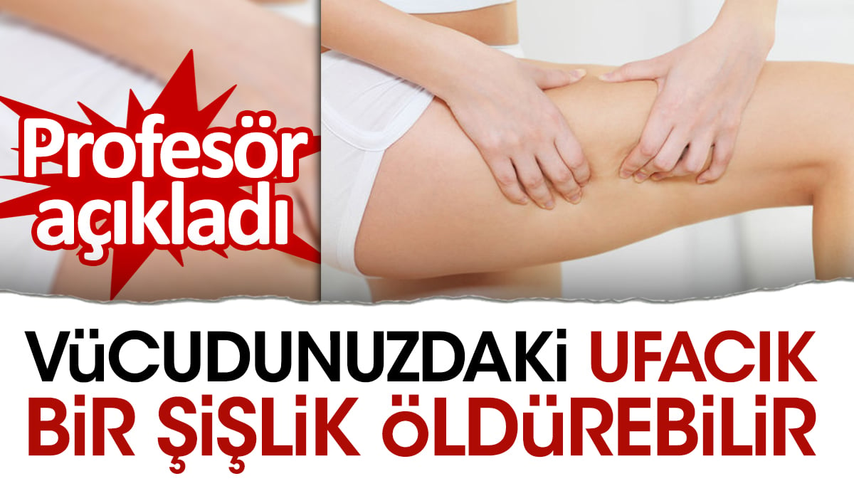 Vücudunuzdaki ufacık bir şişlik öldürebilir. Profesör açıkladı