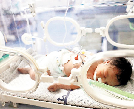 Gazze’nin mucize bebeği sonunda hayata tutundu