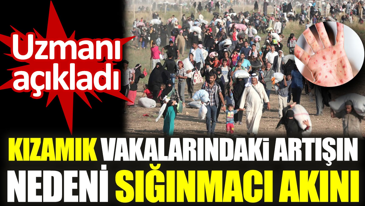 Uzmanı açıkladı: Kızamık vakalarındaki artışın nedeni sığınmacı akını