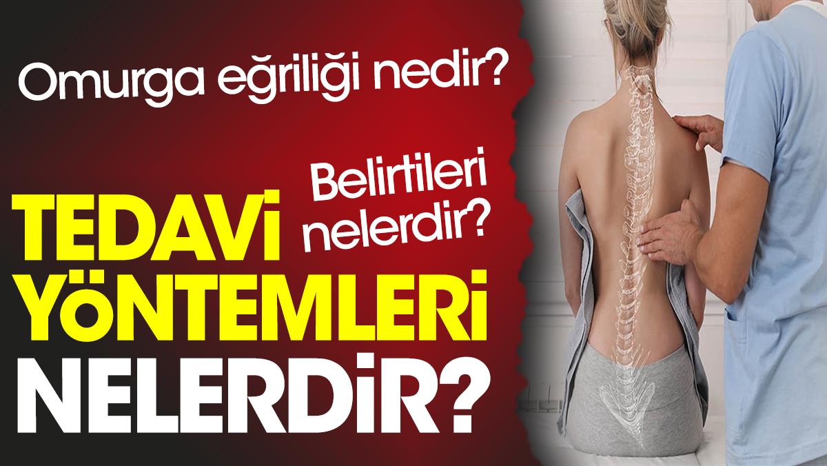 Omurga eğriliği nedir? Belirtileri nelerdir? Tedavi yöntemleri nelerdir?