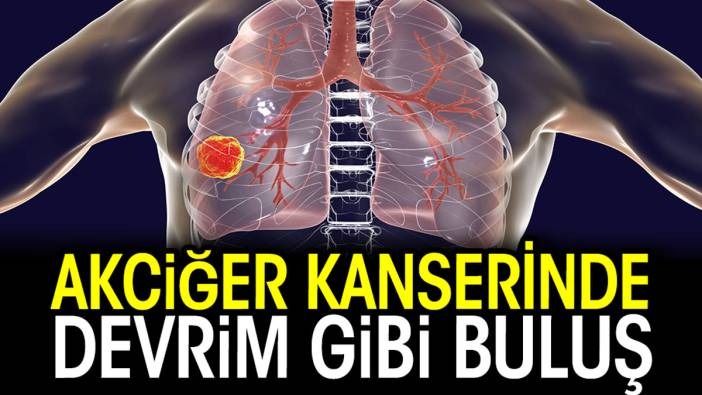 Akciğer kanserinde devrim gibi buluş