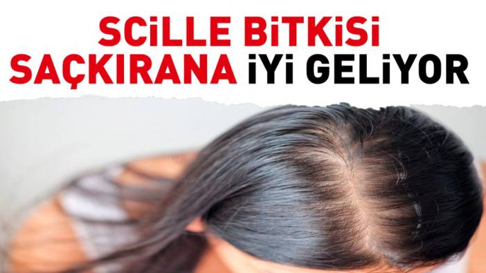 Saçkırana iyi gelen bitki