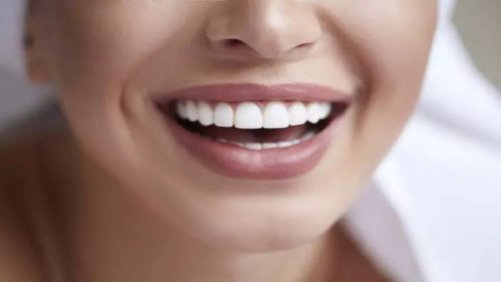 Beyaz dişlerin sırrı olan üç yöntem ortaya çıktı. Haftada bir kez uygulayın. Sarı dişlere veda edin