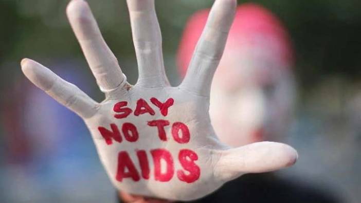 AIDS belirtileri nelerdir hangi hastalıklara neden olur