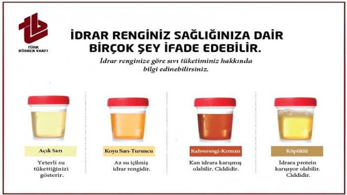 İşte idrar renginizin sırları