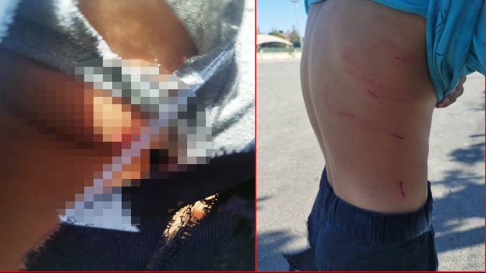 Konya'da başıboş sokak köpeği dehşeti: 8 yaşındaki çocuğa 30 dikiş atıldı