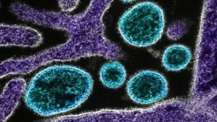 Hindistan'da Nipah virüsü nedeniyle iki kişi hayatını kaybetti