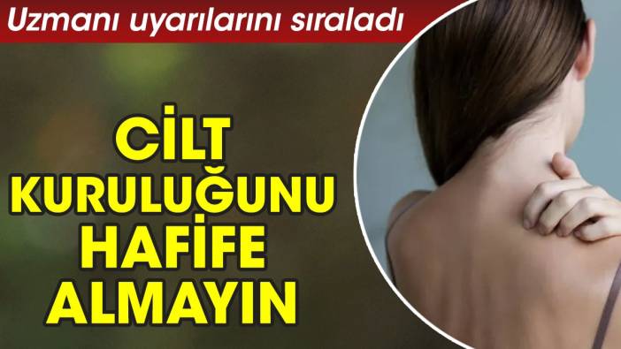 Uzmanı uyarılarını sıraladı. Cilt kuruluğunu hafife almayın