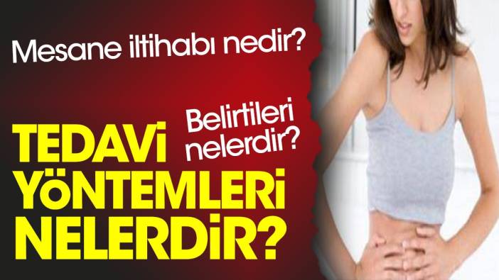 Mesane iltihabı nedir? Belirtileri nelerdir? Tedavi yöntemleri nelerdir?