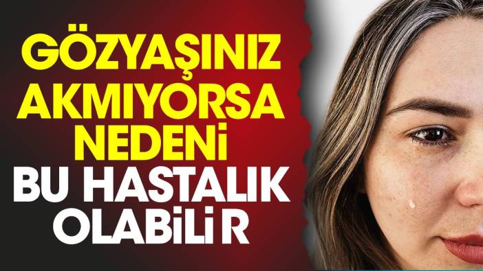 Gözyaşınız akmıyorsa nedeni bu hastalık olabilir