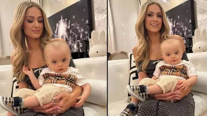 Paris Hilton bebeğinin sağlık durumunu açıkladı. 8 aylık bebeğinin kafası sosyal medyada gündem olmuştu