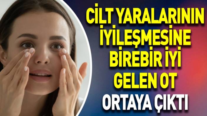 Cilt yaralarının iyileşmesine birebir iyi gelen ot ortaya çıktı