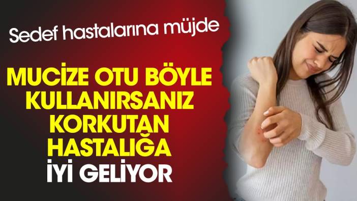 Sedef hastalarına müjde. Mucize otu böyle kullanırsanız korkutan hastalığa iyi geliyor