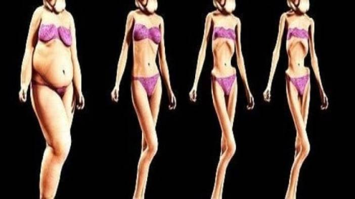 Anoreksiya Nervoza’ya dikkat