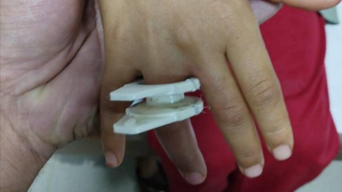 Parmağına plastik parçası sıkışan çocuğu itfaiye kurtardı