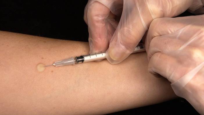 Chikungunya virüsüne karşı ilk aşıya onay çıktı