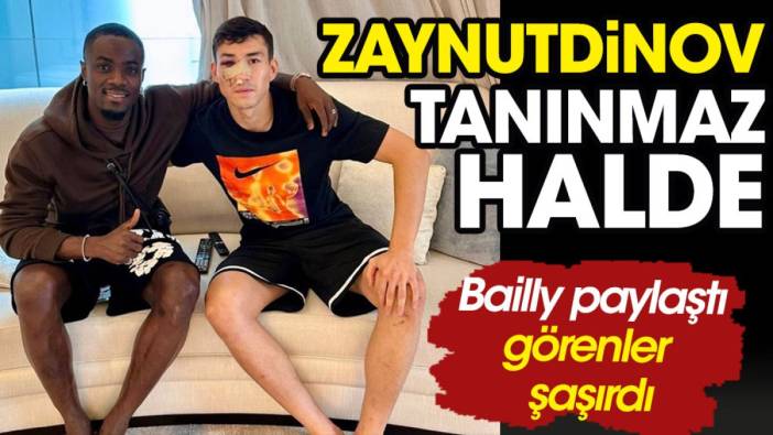 Zaynutdinov'a ilk ziyaret Bailly'den. Son halini görenler tanıyamadı