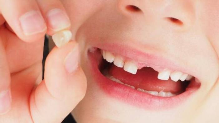 Süt dişleri neden çok önemli