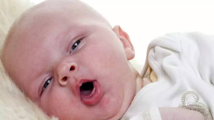 Bebeklerin öksürüğü nasıl kesilir