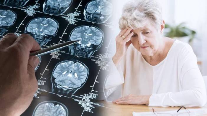 Alzheimere davetiye çıkaran nedenler