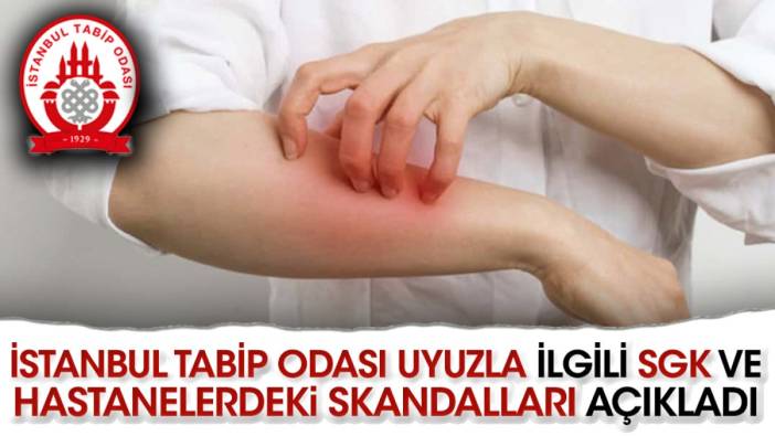 İstanbul Tabip Odası uyuzla ilgili SGK ve hastanelerdeki skandalları açıkladı