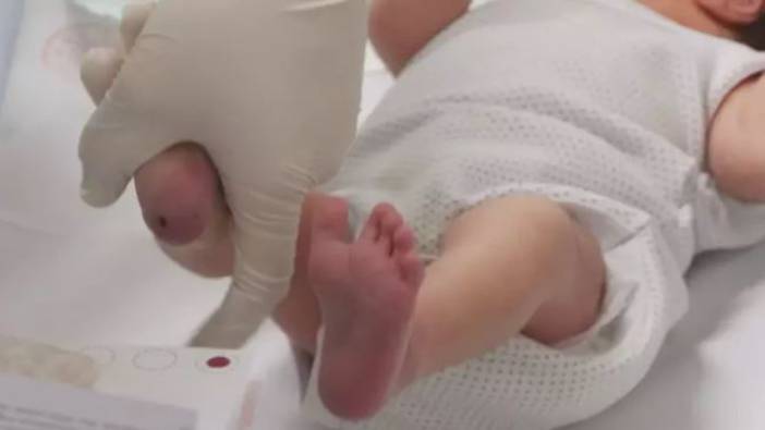 Yenidoğan bebeklerde ölümcül tehlike ortaya çıktı. Uzmanı uyarılarını sıraladı