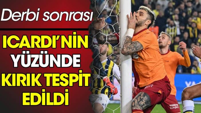 Mauro Icardi'nin yüzünde kırık oluştu