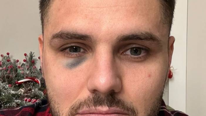 Galatasaray Icardi'nin son durumunu paylaştı. 'Türk futbolunu manipüle etmeye devam ettiler'