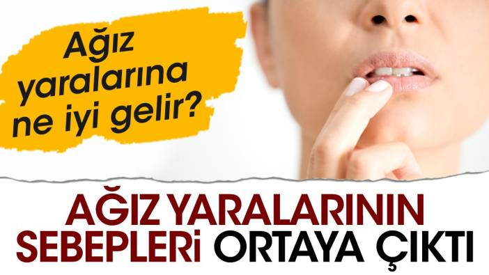 Ağız yaralarının sebepleri ortaya çıktı. Ağız yaralarına ne iyi gelir?